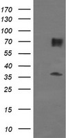 ESRRG / ERR Gamma Antibody - E.coli lysate (5 ug, left lane) and E.coli lysate expressing human recombinant protein fragment (5 ug, right lane) corresponding to amino acids 24-263 of human ESRRG (NP_001429) were separated by SDS-PAGE and immunoblotted with anti-ESRRG.
