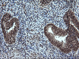 ESRRG / ERR Gamma Antibody - IHC of paraffin-embedded Human endometrium tissue using anti-ESRRG mouse monoclonal antibody.