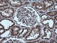 ESRRG / ERR Gamma Antibody - IHC of paraffin-embedded Human Kidney tissue using anti-ESRRG mouse monoclonal antibody.