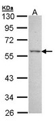 ESRRG / ERR Gamma Antibody - Sample (30 ug of whole cell lysate). A: A431. 10% SDS PAGE. ESRRG antibody diluted at 1:3000