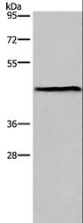 ESRRG / ERR Gamma Antibody - Western blot analysis of Mouse lung tissue, using ESRRG Polyclonal Antibody at dilution of 1:300.