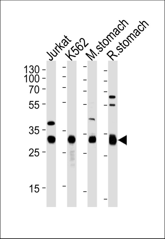 Esterase D / ESD Antibody - Western blot of lysates from Jurkat, K562 cell line, mouse stomach and rat stomach tissue (from left to right) with ESD Antibody. Antibody was diluted at 1:1000 at each lane. A goat anti-rabbit (HRP) at 1:5000 dilution was used as the secondary antibody. Lysates at 35 ug per lane.