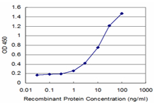 Esterase D / ESD Antibody - Detection limit for recombinant GST tagged ESD is approximately 1 ng/ml as a capture antibody.