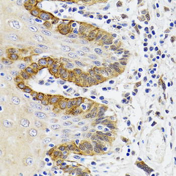 Esterase D / ESD Antibody - Immunohistochemistry of paraffin-embedded Human trachea tissue.