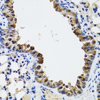 Esterase D / ESD Antibody - Immunohistochemistry of paraffin-embedded mouse lung tissue.