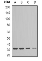 Esterase D / ESD Antibody - Western blot analysis of ESD expression in Jurkat (A); HepG2 (B); mouse liver (C); mouse kidney (D) whole cell lysates.