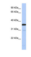 Esterase D / ESD Antibody - ESD antibody Western blot of Fetal Kidney lysate. This image was taken for the unconjugated form of this product. Other forms have not been tested.
