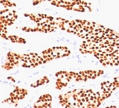 Estrogen Receptor Antibody - Estrogen Receptor antibody ER505 immunohistochemistry.  This image was taken for the unmodified form of this product. Other forms have not been tested.