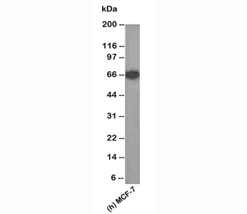 Estrogen Receptor Antibody - Estrogen Receptor antibody ER505 western blot.  This image was taken for the unmodified form of this product. Other forms have not been tested.