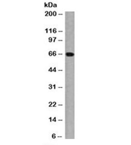 Estrogen Receptor Antibody - Western blot testing of MCF-7 cell lysate with ER antibody (clone ER506). Predicted molecular weight of ER alpha: ~66kDa. This image was taken for the unmodified form of this product. Other forms have not been tested.