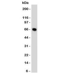 Estrogen Receptor Antibody - MCF7 cells western blot tested with Estrogen receptor antibody (ER505).  This image was taken for the unmodified form of this product. Other forms have not been tested.
