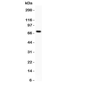 Estrogen Receptor Antibody - Western blot testing of Estrogen Receptor antibody and MCF-7 lysate (human breast tumor cell line). Predicted/observed size ~67KD