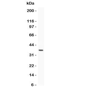 Estrogen Receptor Antibody - Western blot testing of Estrogen Receptor antibody and recombinant human protein (0.5ng)