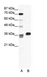 ESX1 Antibody - A: Marker, B: HepG2 Cell Lysate.  This image was taken for the unconjugated form of this product. Other forms have not been tested.