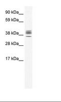 ESX1 Antibody - Testis Lysate.  This image was taken for the unconjugated form of this product. Other forms have not been tested.
