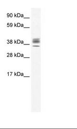 ESX1 Antibody - Testis Lysate.  This image was taken for the unconjugated form of this product. Other forms have not been tested.