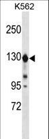 ESYT1 Antibody - ESYT1 Antibody western blot of K562 cell line lysates (35 ug/lane). The ESYT1 antibody detected the ESYT1 protein (arrow).