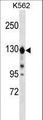 ESYT1 Antibody - ESYT1 Antibody western blot of K562 cell line lysates (35 ug/lane). The ESYT1 antibody detected the ESYT1 protein (arrow).