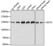 ESYT1 Antibody - Western blot analysis of extracts of various cell lines, using ESYT1 antibody at 1:1000 dilution. The secondary antibody used was an HRP Goat Anti-Rabbit IgG (H+L) at 1:10000 dilution. Lysates were loaded 25ug per lane and 3% nonfat dry milk in TBST was used for blocking. An ECL Kit was used for detection and the exposure time was 5s.