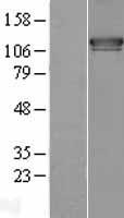 ESYT1 Protein - Western validation with an anti-DDK antibody * L: Control HEK293 lysate R: Over-expression lysate