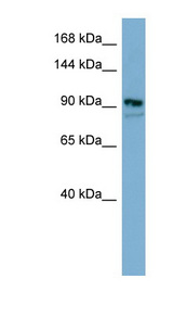 ESYT2 / E-Syt2 Antibody - ESYT2 antibody Western blot of HT1080 cell lysate. This image was taken for the unconjugated form of this product. Other forms have not been tested.