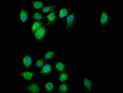 ESYT2 / E-Syt2 Antibody - Immunofluorescence staining of A549 cells at a dilution of 1:200, counter-stained with DAPI. The cells were fixed in 4% formaldehyde, permeabilized using 0.2% Triton X-100 and blocked in 10% normal Goat Serum. The cells were then incubated with the antibody overnight at 4 °C.The secondary antibody was Alexa Fluor 488-congugated AffiniPure Goat Anti-Rabbit IgG (H+L) .