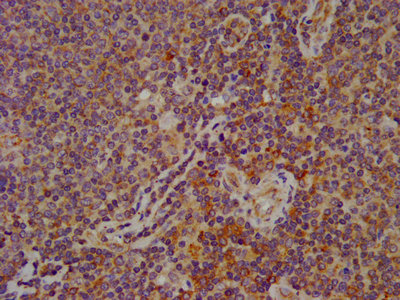 ESYT2 / E-Syt2 Antibody - IHC image of ESYT2 Antibody diluted at 1:600 and staining in paraffin-embedded human lymph node tissue performed on a Leica BondTM system. After dewaxing and hydration, antigen retrieval was mediated by high pressure in a citrate buffer (pH 6.0). Section was blocked with 10% normal goat serum 30min at RT. Then primary antibody (1% BSA) was incubated at 4°C overnight. The primary is detected by a biotinylated secondary antibody and visualized using an HRP conjugated SP system.