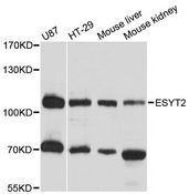 ESYT2 / E-Syt2 Antibody - Western blot analysis of extracts of various cell lines, using ESYT2 antibody at 1:3000 dilution. The secondary antibody used was an HRP Goat Anti-Rabbit IgG (H+L) at 1:10000 dilution. Lysates were loaded 25ug per lane and 3% nonfat dry milk in TBST was used for blocking. An ECL Kit was used for detection and the exposure time was 5s.