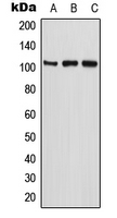 ETAA1 Antibody - Western blot analysis of ETAA1 expression in U2OS (A); MCF7 (B); PC12 (C) whole cell lysates.