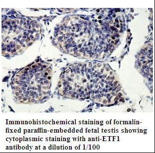 ETF1 / ERF1 Antibody