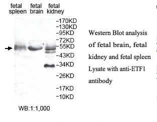 ETF1 / ERF1 Antibody
