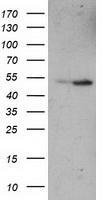 ETF1 / ERF1 Antibody - HEK293T cells were transfected with the pCMV6-ENTRY control (Left lane) or pCMV6-ENTRY ETF1 (Right lane) cDNA for 48 hrs and lysed. Equivalent amounts of cell lysates (5 ug per lane) were separated by SDS-PAGE and immunoblotted with anti-ETF1.