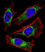 ETFA Antibody - Fluorescent image of HeLa cells stained with ETFA Antibody. Antibody was diluted at 1:25 dilution. An Alexa Fluor 488-conjugated goat anti-rabbit lgG at 1:400 dilution was used as the secondary antibody (green). DAPI was used to stain the cell nuclear (blue). Cytoplasmic actin was counterstained with Alexa Fluor 555 conjugated with Phalloidin (red).