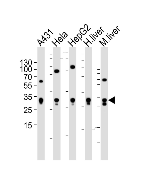 ETFA Antibody - Western blot of lysates from A431, HeLa, HepG2 cell line , human liver and mouse liver tissue lysate (from left to right) with ETFA Antibody. Antibody was diluted at 1:1000 at each lane. A goat anti-rabbit IgG H&L (HRP) at 1:5000 dilution was used as the secondary antibody. Lysates at 35 ug per lane.