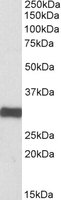 ETFA Antibody - ETFA antibody (0.1 ug/ml) staining of Human Heart lysate (35 ug protein/ml in RIPA buffer). Primary incubation was 1 hour. Detected by chemiluminescence.