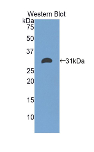 ETFA Antibody - Western blot of recombinant ETFA.  This image was taken for the unconjugated form of this product. Other forms have not been tested.