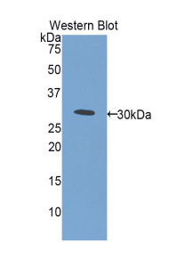 ETFA Antibody - Western blot of recombinant ETFA.  This image was taken for the unconjugated form of this product. Other forms have not been tested.