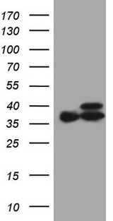 ETFA Antibody - HEK293T cells were transfected with the pCMV6-ENTRY control. (Left lane) or pCMV6-ENTRY ETFA. (Right lane) cDNA for 48 hrs and lysed. Equivalent amounts of cell lysates. (5 ug per lane) were separated by SDS-PAGE and immunoblotted with anti-ETFA. (1:2000)
