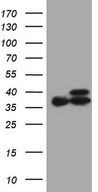 ETFA Antibody - HEK293T cells were transfected with the pCMV6-ENTRY control (Left lane) or pCMV6-ENTRY ETFA (Right lane) cDNA for 48 hrs and lysed. Equivalent amounts of cell lysates (5 ug per lane) were separated by SDS-PAGE and immunoblotted with anti-ETFA (1:2000).