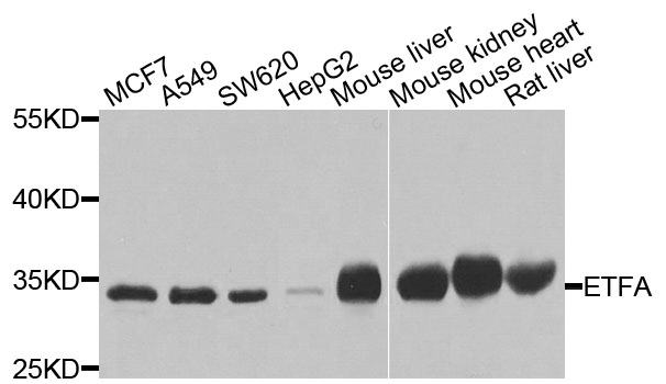 ETFA Antibody - Western blot analysis of extracts of various cells.
