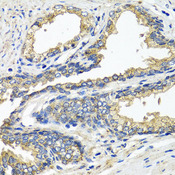 ETFA Antibody - Immunohistochemistry of paraffin-embedded human prostate.