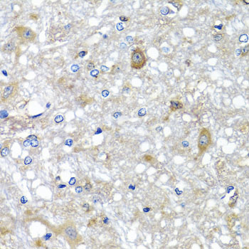 ETFA Antibody - Immunohistochemistry of paraffin-embedded rat brain tissue.