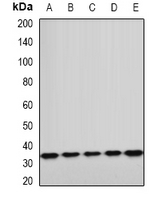 ETFA Antibody - Western blot analysis of ETFA expression in A549 (A); HepG2 (B); mouse kidney (C); mouse heart (D); rat liver (E) whole cell lysates.