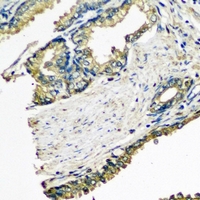 ETFA Antibody - Immunohistochemical analysis of ETFA staining in human prostate formalin fixed paraffin embedded tissue section. The section was pre-treated using heat mediated antigen retrieval with sodium citrate buffer (pH 6.0). The section was then incubated with the antibody at room temperature and detected using an HRP conjugated compact polymer system. DAB was used as the chromogen. The section was then counterstained with hematoxylin and mounted with DPX.