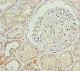 ETFA Antibody - Immunohistochemistry of paraffin-embedded human kidney tissue at dilution 1:100