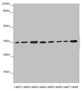 ETFA Antibody - Western blot All Lanes: ETFA antibody at 2.88 ug/ml Lane 1 : Mouse small intestine tissue Lane 2 : Mouse liver tissue Lane 3 : A431 whole cell lysate Lane 4 : Hela whole cell lysate Lane 5 : K562 whole cell lysate Lane 6 : A549 whole cell lysate Lane 7 : HepG-2 whole cell lysate Lane 8 : MCF7 whole cell lysate Secondary Goat polyclonal to rabbit IgG at 1/10000 dilution Predicted band size: 36,31 kDa Observed band size: 35 kDa