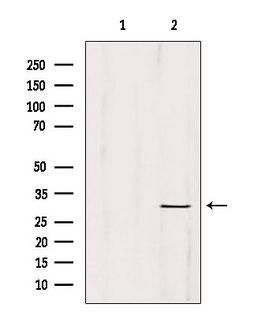 ETFA Antibody - Western blot analysis of extracts of HepG2 cells using ETFA antibody. Lane 1 was treated with the blocking peptide.