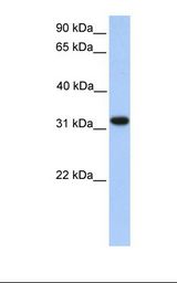 ETFA Antibody - Fetal heart lysate. Antibody concentration: 1.0 ug/ml. Gel concentration: 12%.  This image was taken for the unconjugated form of this product. Other forms have not been tested.