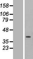 ETFA Protein - Western validation with an anti-DDK antibody * L: Control HEK293 lysate R: Over-expression lysate