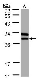 ETFB Antibody - Sample (30 ug of whole cell lysate). A: MOLT4 . 12% SDS PAGE. ETFB antibody diluted at 1:1000